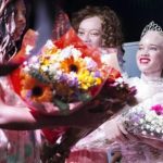 Zimbabwe : des reines de beauté albinos pour lutter contre les préjugés