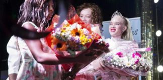 Zimbabwe : des reines de beauté albinos pour lutter contre les préjugés