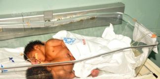 Santé : les sœurs siamoises nées au CHR de Man pourront être opérées et séparées à Abidjan