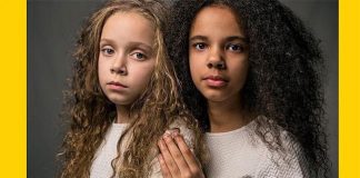 Royaume-Uni: Des Jumelles pas comme les autres