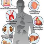 Le diabète : une maladie à prendre au sérieux Le -diabète – une- maladie- à –prendre- au- sérieux