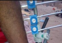 Ayouba Ag Manaou, blessé par balle de l’armée française à Intagom