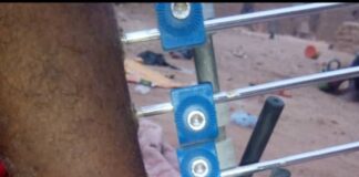 Ayouba Ag Manaou, blessé par balle de l’armée française à Intagom